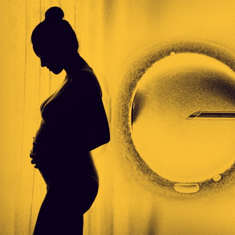 Image: The fertility industry--expected to burgeon to $41 billion by 2026--is dangerously glossing over what science tells us these treatments can and can't offer.