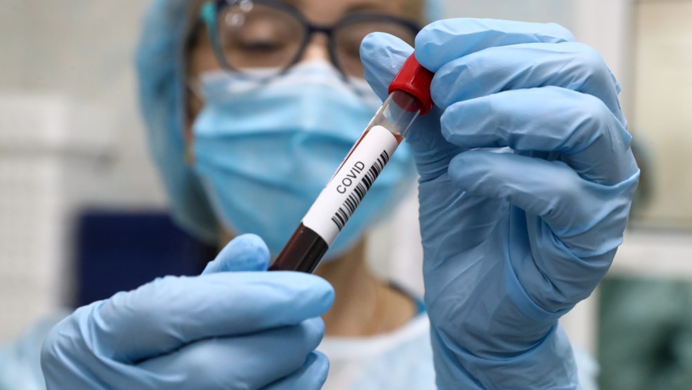 A healthcare worker holds a vial with a blood sample while performing antibody tests for SARS-CoV-2 at the SklifLab laboratory of the Sklifosovsky Research Institute of Emergency Care on May 29, 2020, in Moscow.