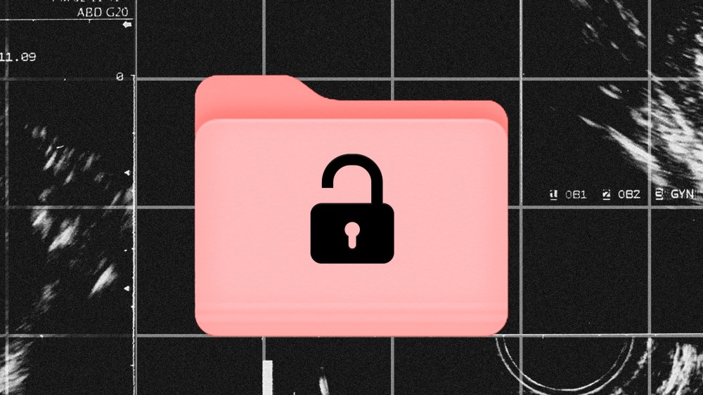 Photo illustration: An open lock on a salmon colored computer folder against a background of grid showing parts of a sonogram.