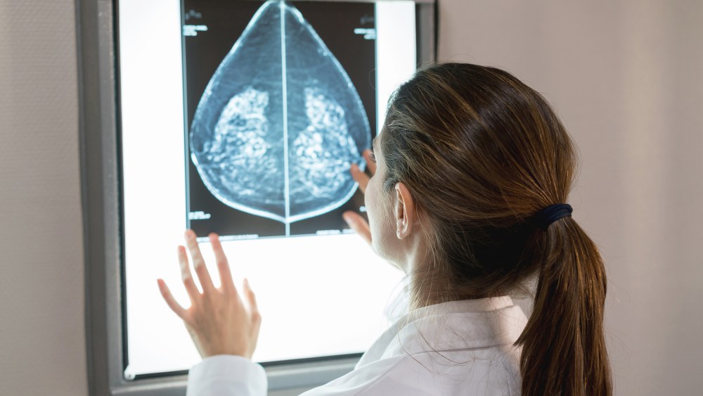 Image: Unrecognizable female gynocologist looking at a mammogram at the hospital
