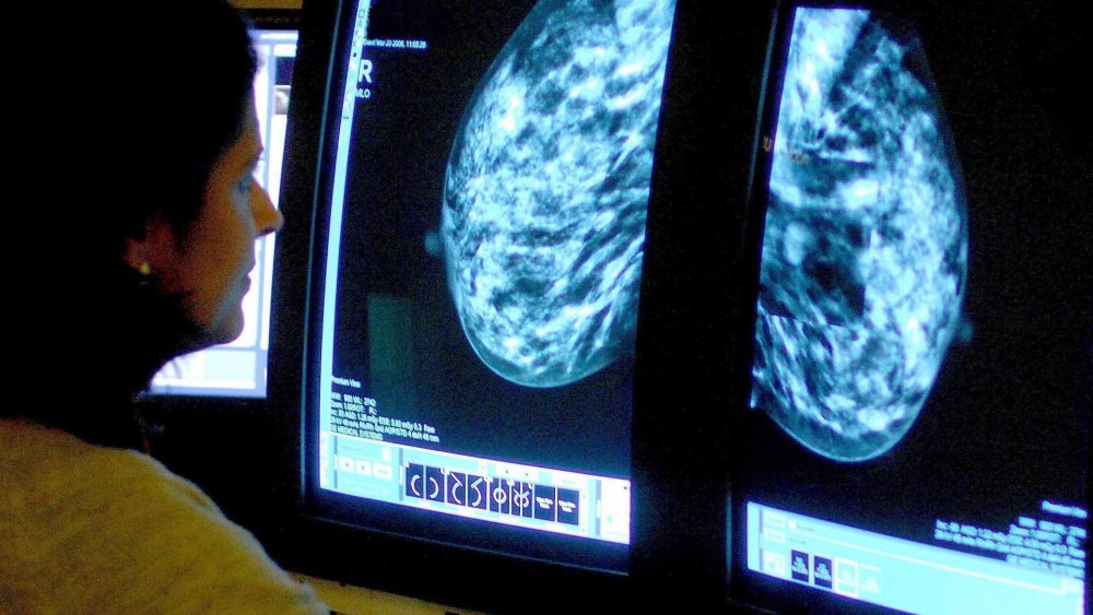 Image: A consultant analyzing a mammogram