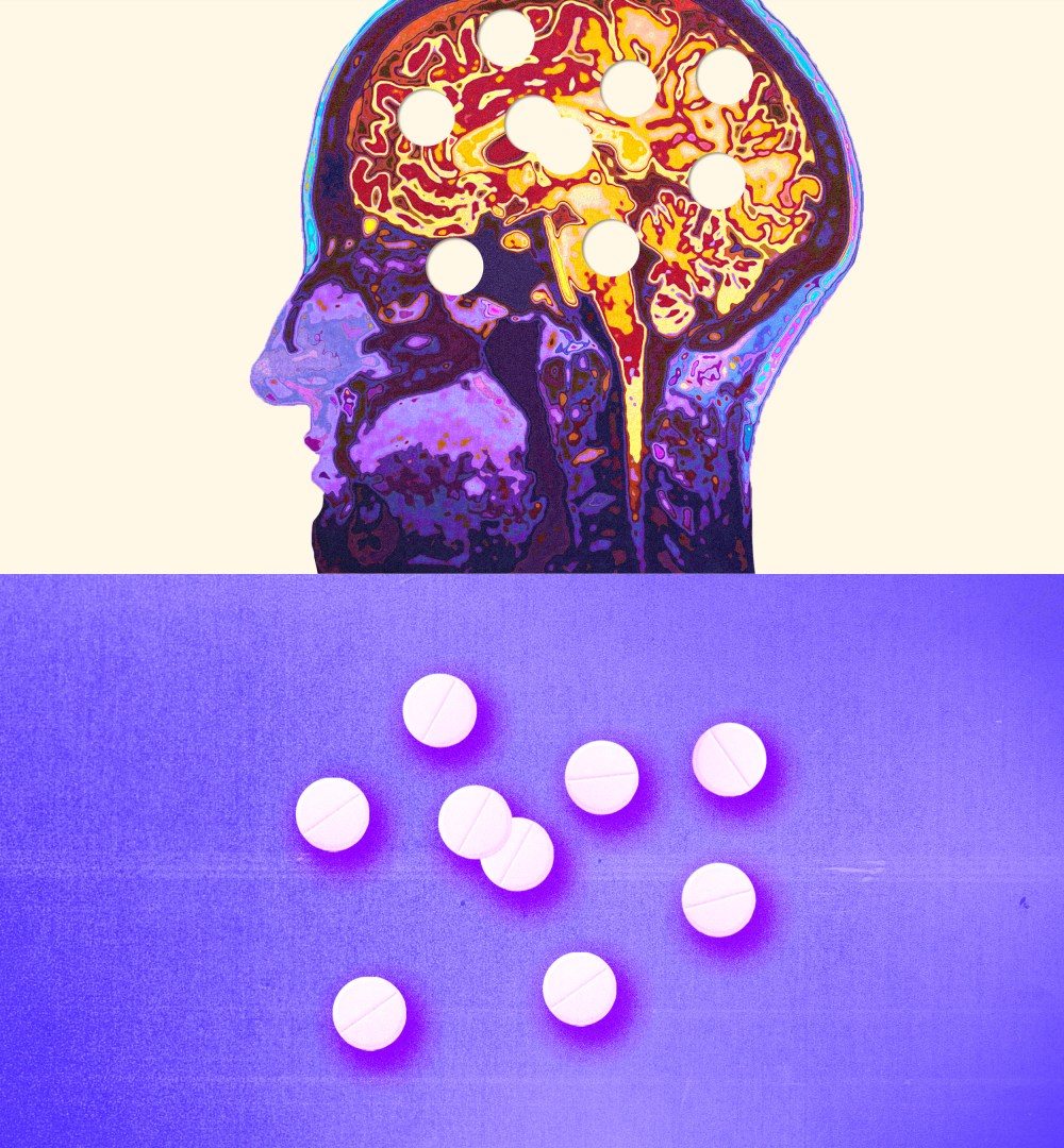 Photo Illustration: An image of a color brain scan and Adderall pills