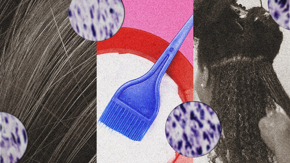 Photo illustration of straight and curly hair, chemical straightening cream and micrograph of cancer cell in human fibroma tumor.