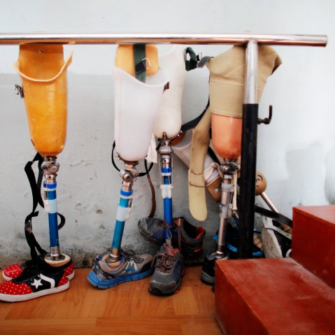 Prosthetics are seen lined up for patients who lost their leg in the earthquake that struck the country earlier this year in Kathmandu, Nepal, Dec. 2, 2015. (Photo by Niranjan Shrestha/AP)