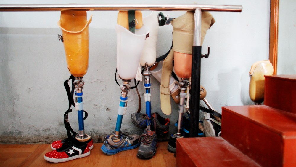 Prosthetics are seen lined up for patients who lost their leg in the earthquake that struck the country earlier this year in Kathmandu, Nepal, Dec. 2, 2015. (Photo by Niranjan Shrestha/AP)