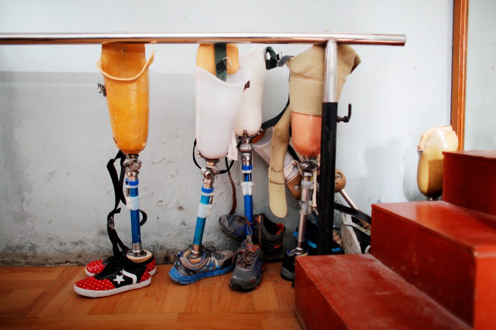 Prosthetics are seen lined up for patients who lost their leg in the earthquake that struck the country earlier this year in Kathmandu, Nepal, Dec. 2, 2015. (Photo by Niranjan Shrestha/AP)
