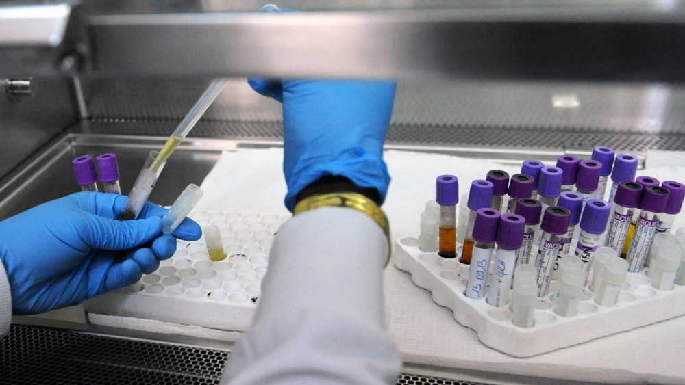 A laboratory technician at the AIDS Research Center of the Treichville hospital in Abidjan works on blood samples of people living with HIV on Sept. 13, 2013. (Photo by Sia Kambou/AFP/Getty)
