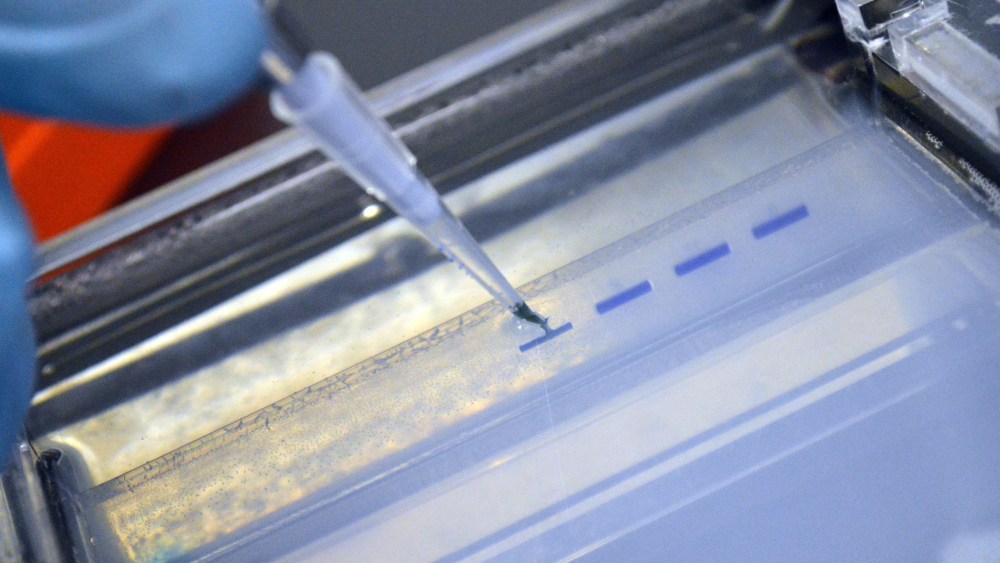 A researcher injects cells into a gel on July 31, 2014. (Photo by William Thomas Cain/Getty)
