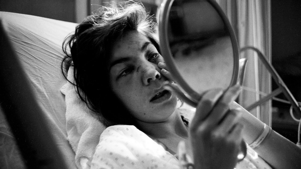 Diane, who was beaten by her spouse, looks in the mirror at a hospital.