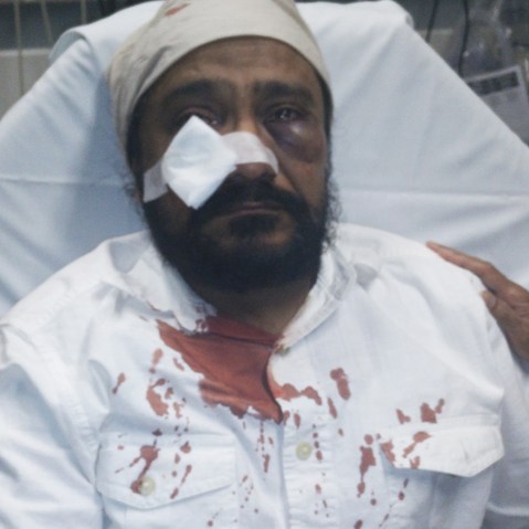 Inderjit Singh Mukker after he was attacked. (Photo courtesy of the Mukker family/The Sikh Coalition)