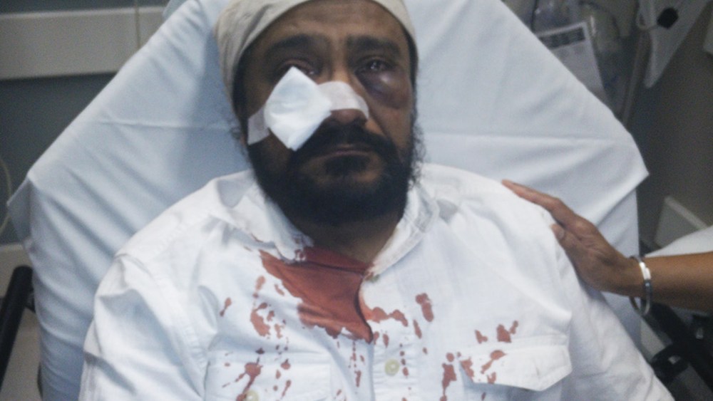 Inderjit Singh Mukker after he was attacked. (Photo courtesy of the Mukker family/The Sikh Coalition)
