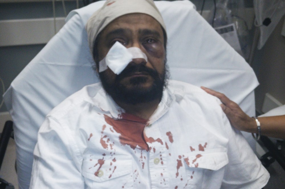 Inderjit Singh Mukker after he was attacked. (Photo courtesy of the Mukker family/The Sikh Coalition)