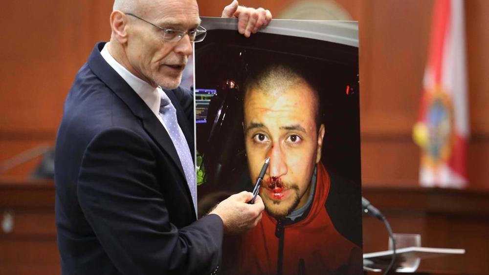 Don West, a defense attorney for George Zimmerman, displays a photo of his client from the night of the shooting during opening statements in Zimmerman’s trial. (AP Photo/Orlando Sentinel, Joe Burbank, Pool)