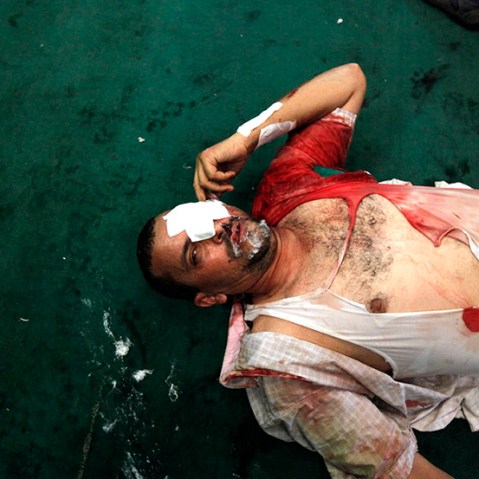 An injured protester who supports ousted Egyptian President Mohammed Morsi lies inside a mosque in Ramses Square in Cairo, August 16, 2013. (Photo by Mohamed Abd El Ghany/Reuters)