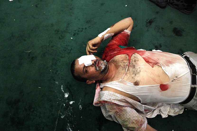 An injured protester who supports ousted Egyptian President Mohammed Morsi lies inside a mosque in Ramses Square in Cairo, August 16, 2013. (Photo by Mohamed Abd El Ghany/Reuters)