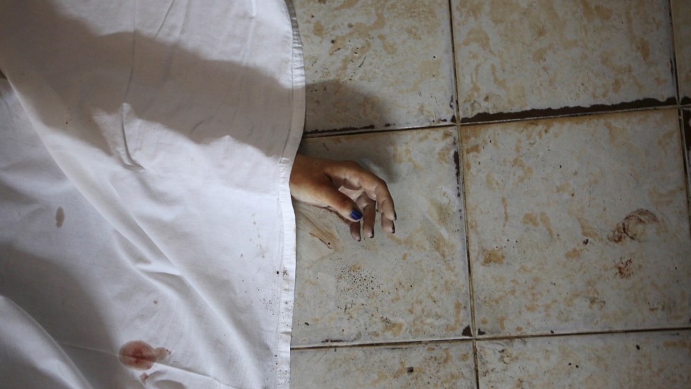 The hand of a person killed is seen after an attack in Grand Bassam, Ivory Coast, March 13, 2016. (Photo by Joe Penney/Reuters)