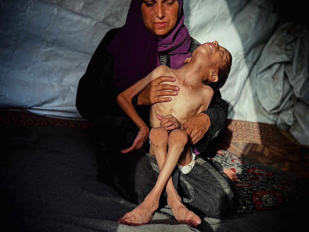 A mother holds her malnourished son inside their makeshift tent.