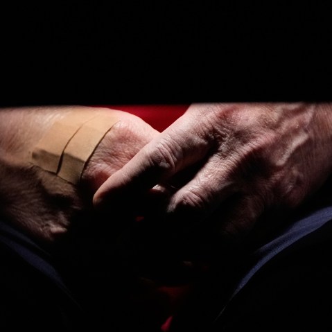 President Trump's right hand is covered with bandaids during a cabinet meeting.