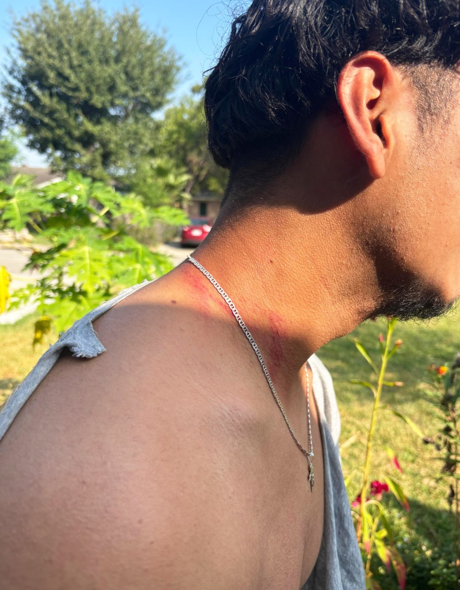 Arnoldo’s oldest sister, Maria, took photos of her little brother after he walked up to their home covered in injuries.