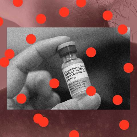 A photo collage showing the measles vaccine overlaying a young woman with the virus