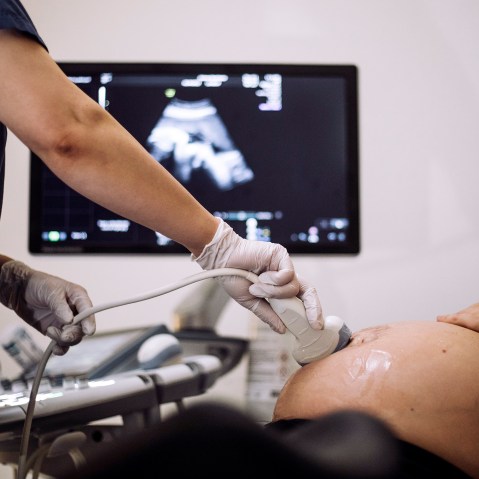 A doctor performs ultrasound on a pregnant patient.